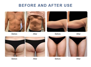 cryolipolysis +ems slimming machine